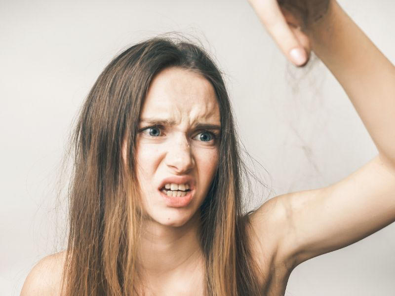 opadanje kose na temenu kod žena