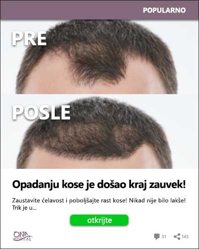 baner za opadanje kose muškarci