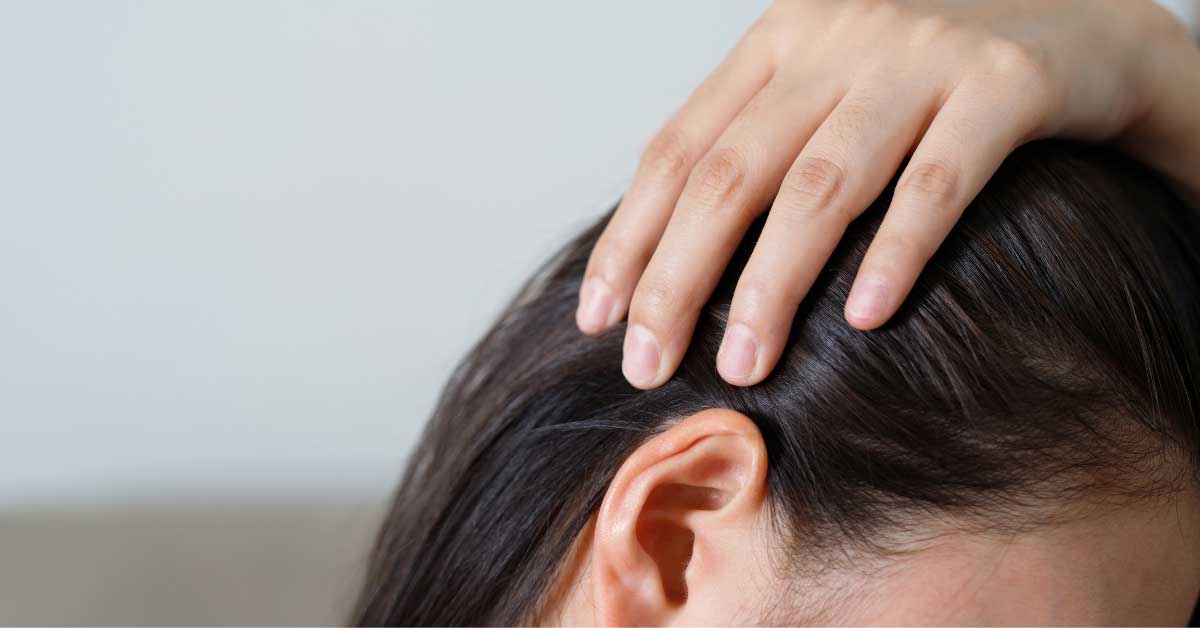  Najbolji šampon za seboreični dermatitis. Evo liste!